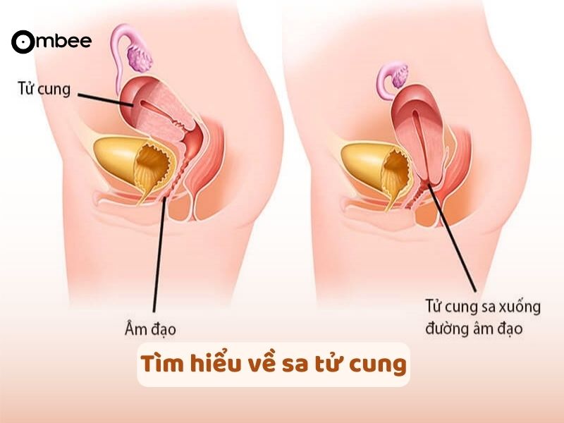 meo-dan-gian-tri-sa-tu-cung